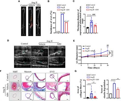 Anemoside B4 attenuates abdominal aortic aneurysm by limiting smooth muscle cell transdifferentiation and its mediated inflammation